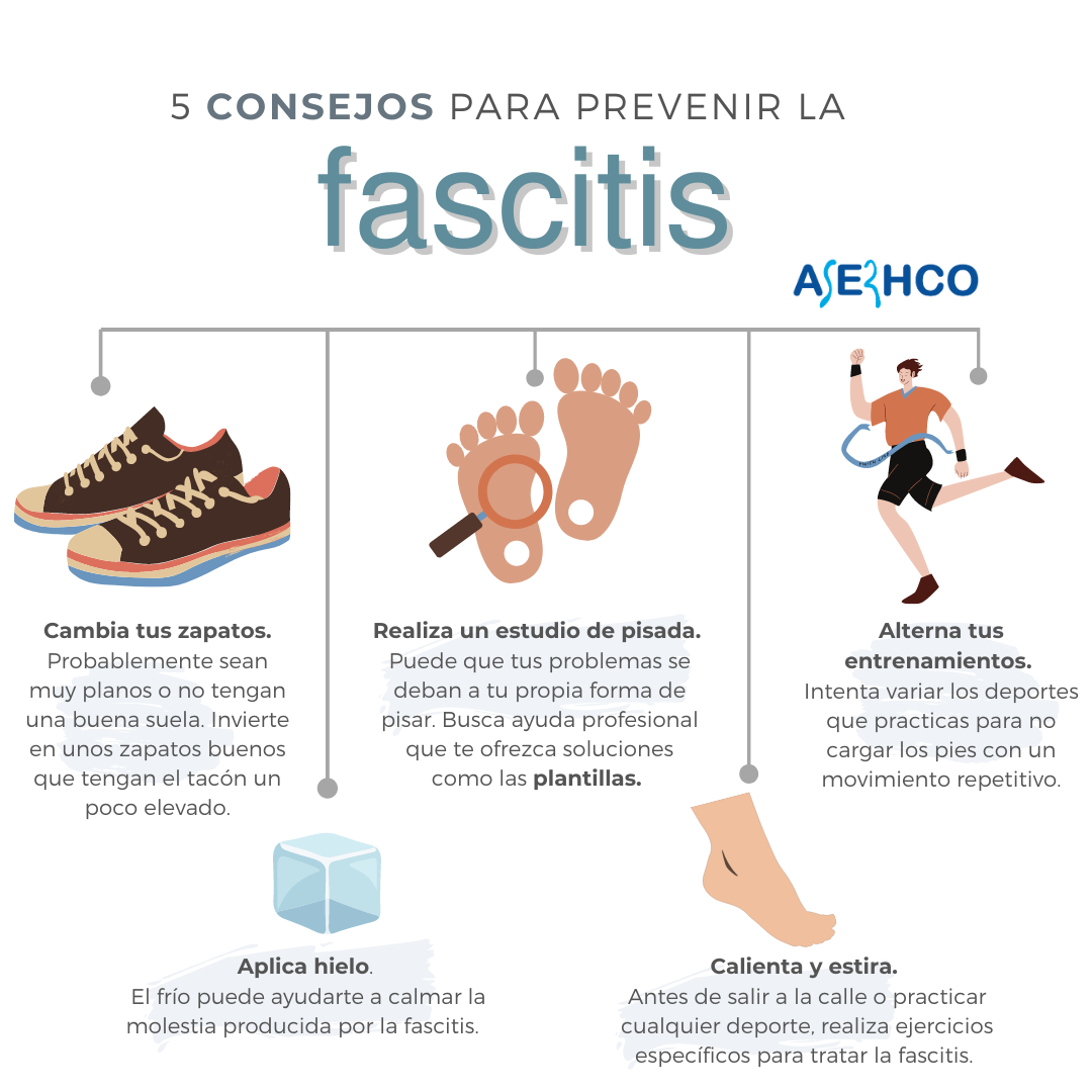 fascitis plantar